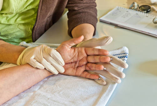 Occupational Therapy